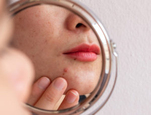 Young beauty woman checking her skin at mirror in the morning | Revive MD Inc in Barrie, ON