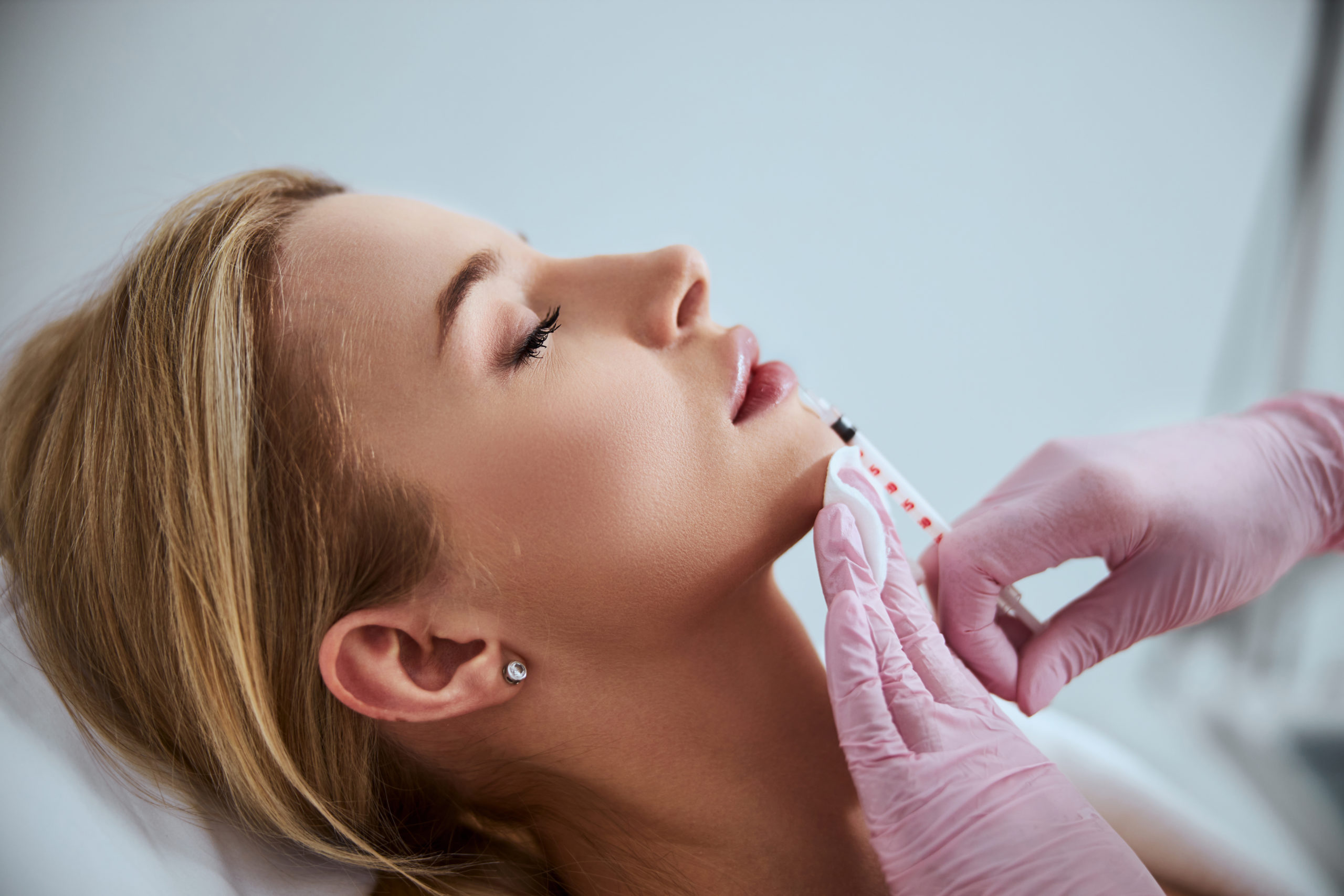 Side View of a Woman Undergoing the Lip Augmentation Procedure | Revive MD Inc in Barrie, ON