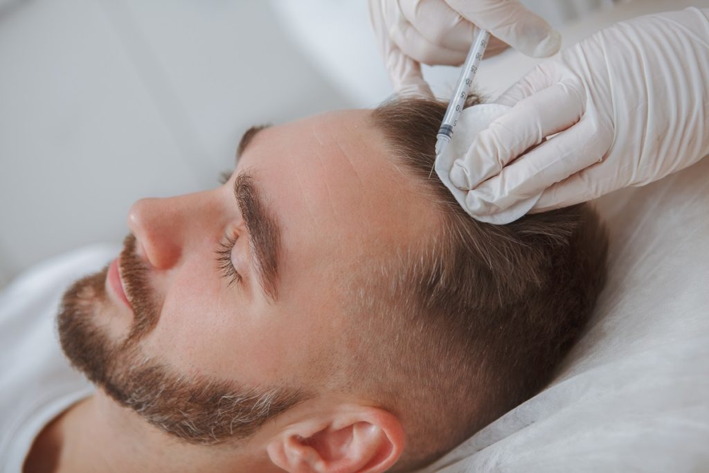 Aesthetician giving hairloss treatment injections into scalp of male client | Revive MD Inc in Barrie, ON