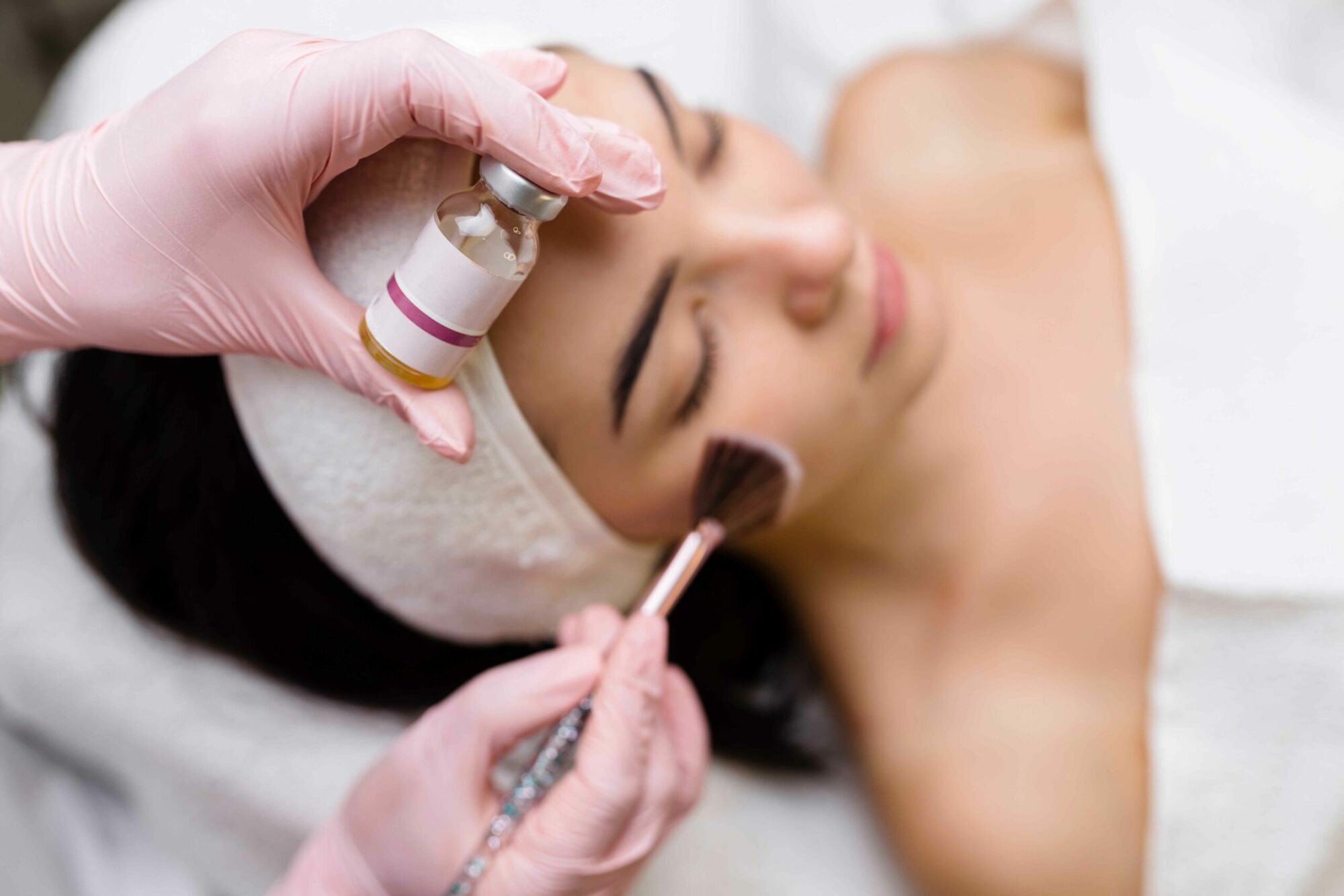 Young Attractive Woman Undergoing Chemical Peels Treatment | Revive MD Inc in Barrie, ON