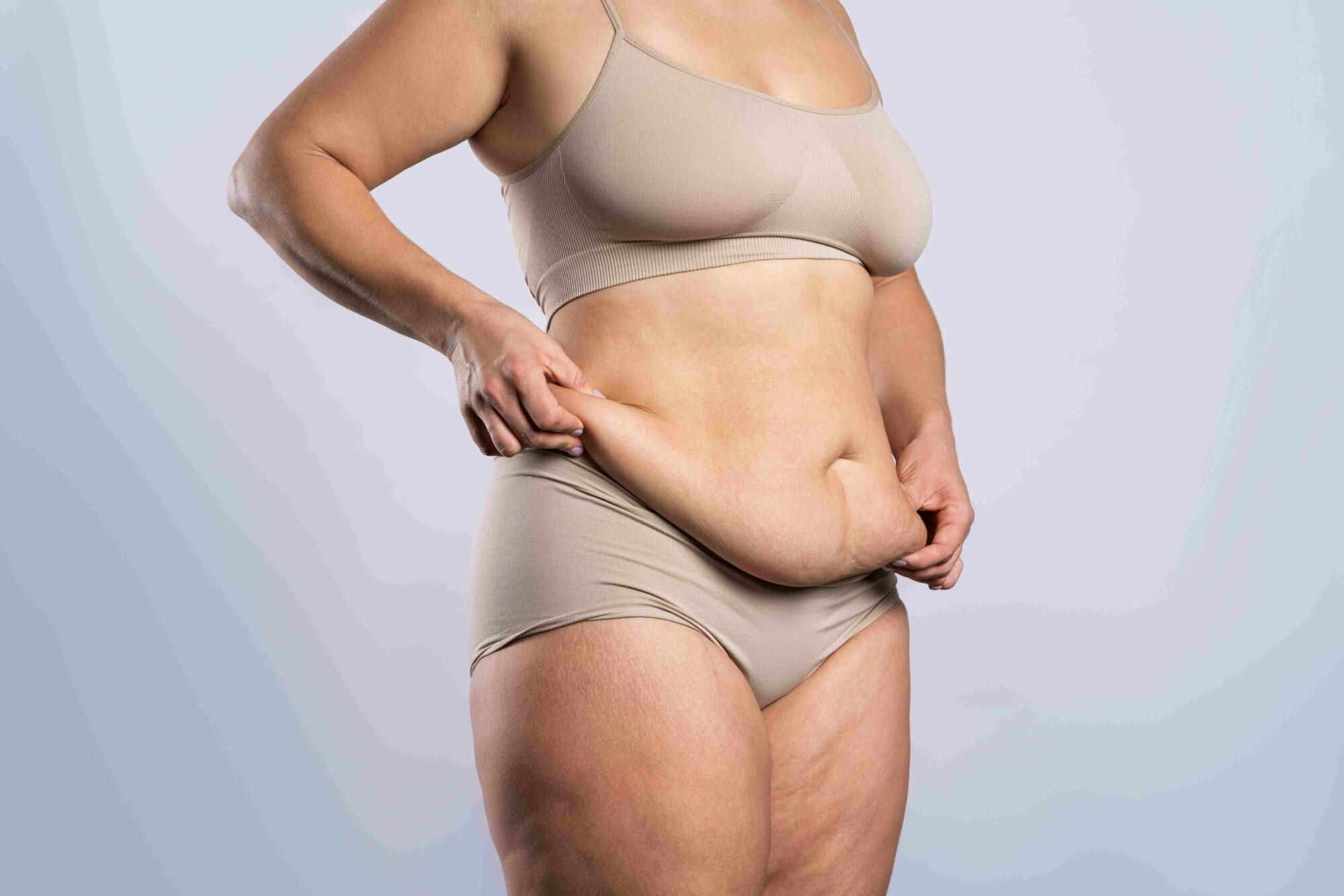 Woman Pinching Belly Fat | Revive MD Inc in Barrie, ON