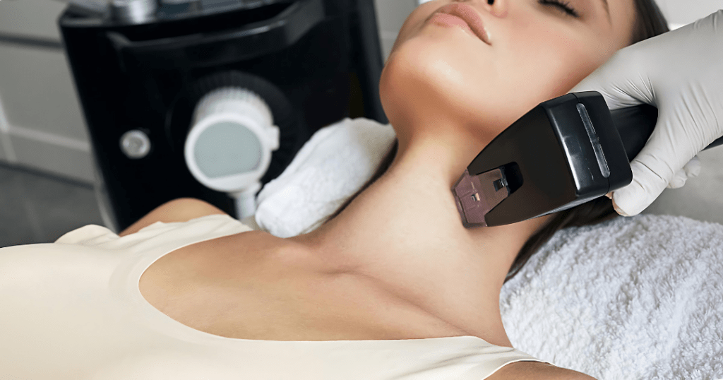 Morpheus 8 treatment at Revive Medical Spa Barrie