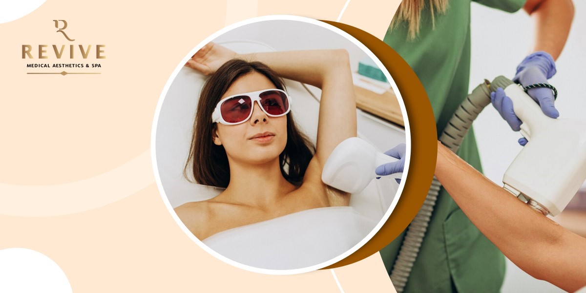 A Comprehensive Guide for Laser Hair Removal in Barrie