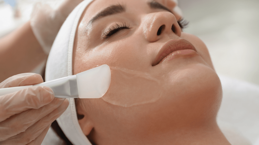 Application process of chemical peels in Ontario, demonstrating the treatment being applied to the skin