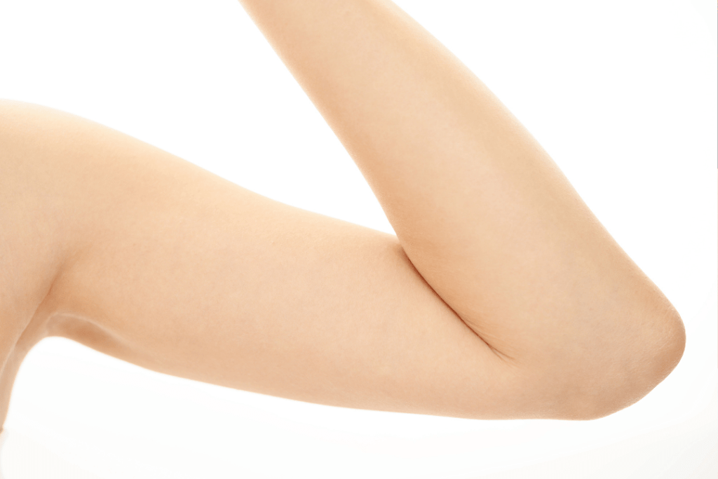 Laser Hair Removal Barrie for arms, highlighting the removal of unwanted hair and improved skin texture