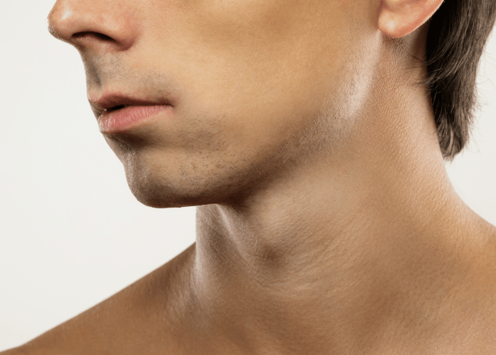 Jawline treatment before and after in Barrie at Revive Medical Aesthetics & Spa