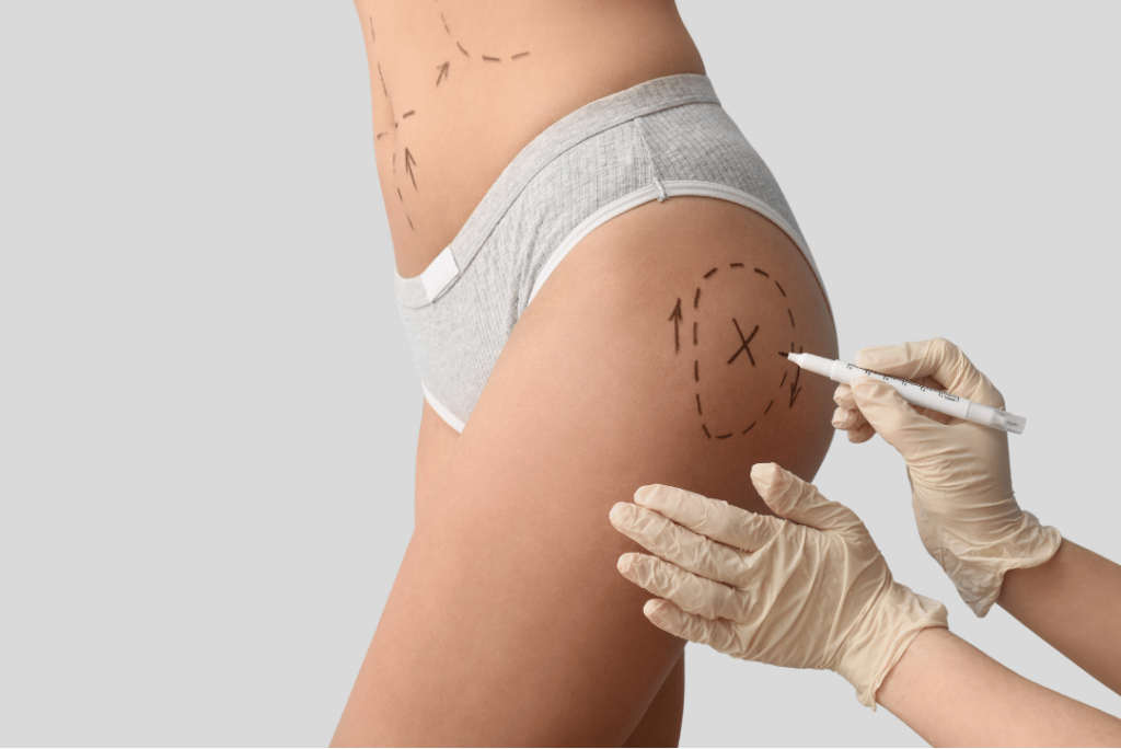 During a personalized consultation, a specialist listens to a client's goals, explaining how a non-surgical butt injections lift can achieve subtle, long-lasting results